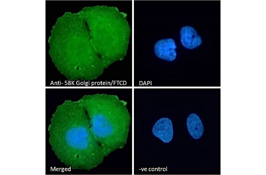 Immunofluorescence - Anti-58K Golgi Protein Antibody (A83551) - Antibodies.com
