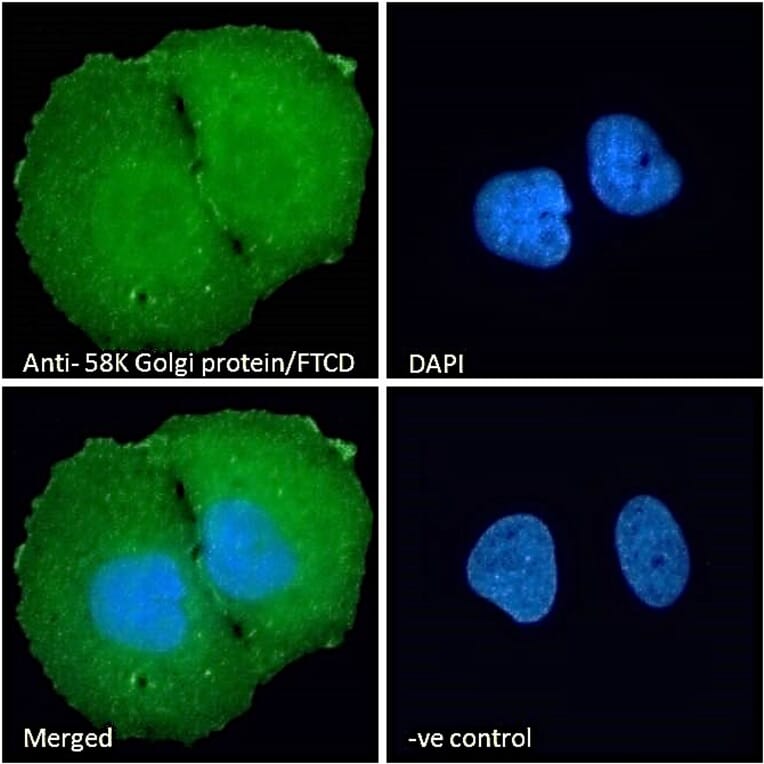 Immunofluorescence - Anti-58K Golgi Protein Antibody (A83551) - Antibodies.com