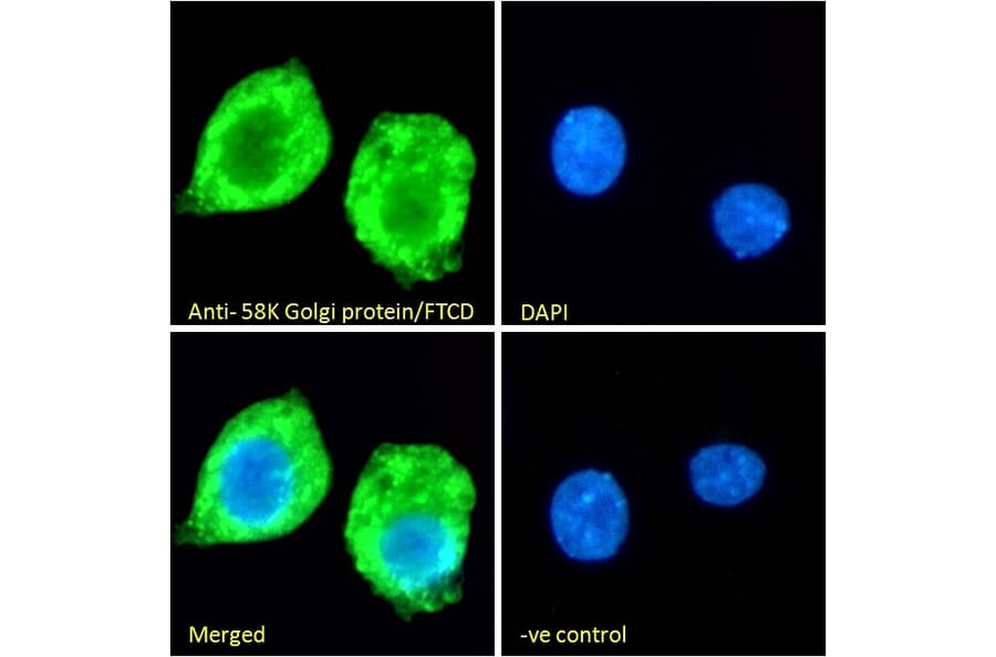 Immunofluorescence - Anti-58K Golgi Protein Antibody (A83551) - Antibodies.com