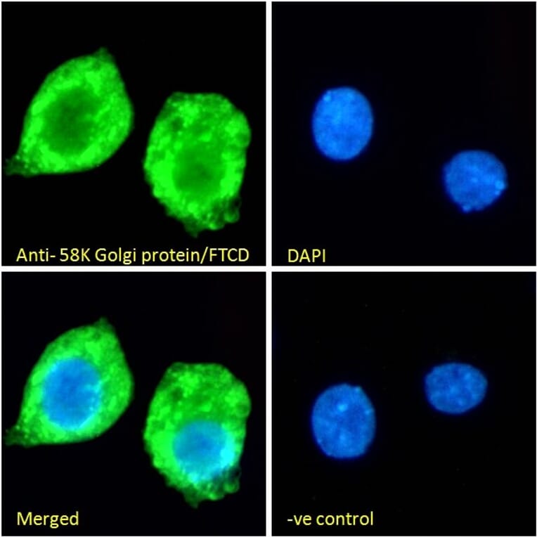 Immunofluorescence - Anti-58K Golgi Protein Antibody (A83551) - Antibodies.com