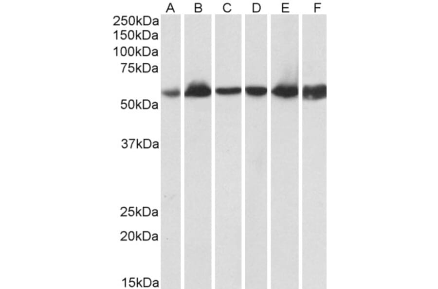 Western Blot - Anti-Hsp60 Antibody (A83554) - Antibodies.com