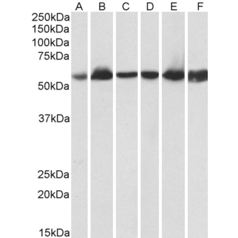Western Blot - Anti-Hsp60 Antibody (A83554) - Antibodies.com