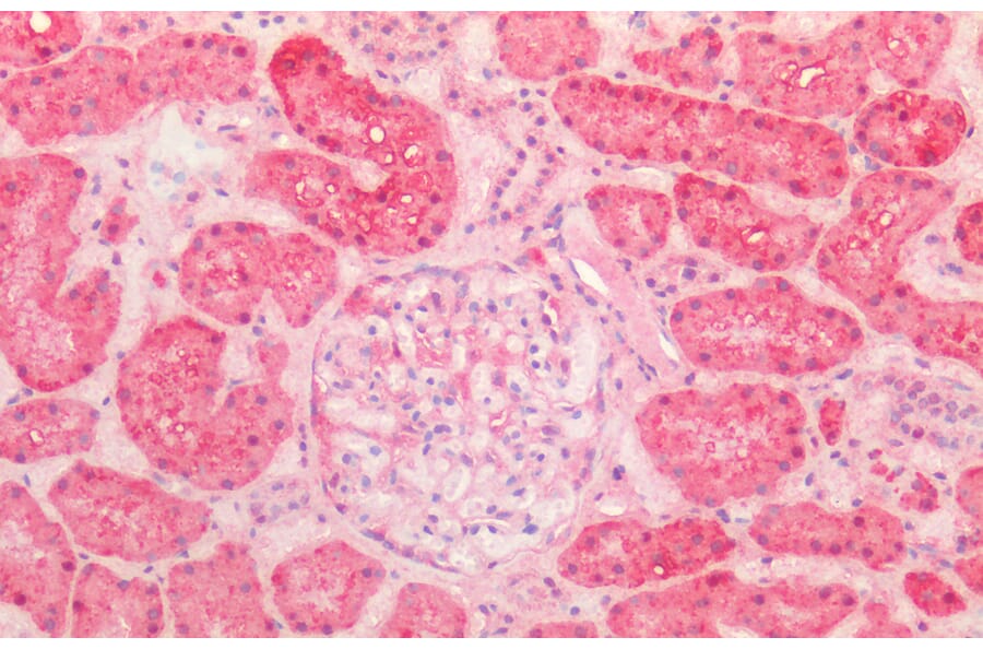 Immunohistochemistry - Anti-Hsp60 Antibody (A83554) - Antibodies.com