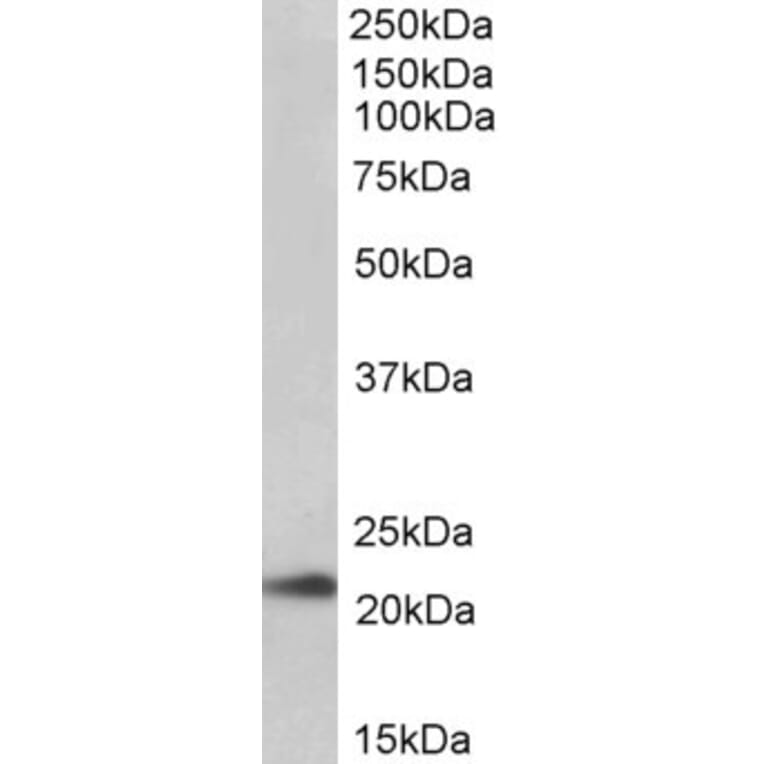 Western Blot - Anti-TMEM205 Antibody (A83555) - Antibodies.com
