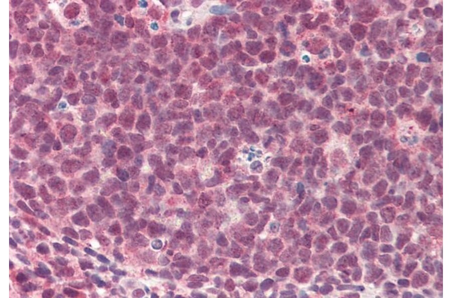 Immunohistochemistry - Anti-TMEM205 Antibody (A83555) - Antibodies.com