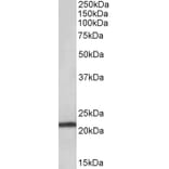 Western Blot - Anti-TMEM205 Antibody (A83556) - Antibodies.com