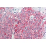 Immunohistochemistry - Anti-TMEM205 Antibody (A83556) - Antibodies.com