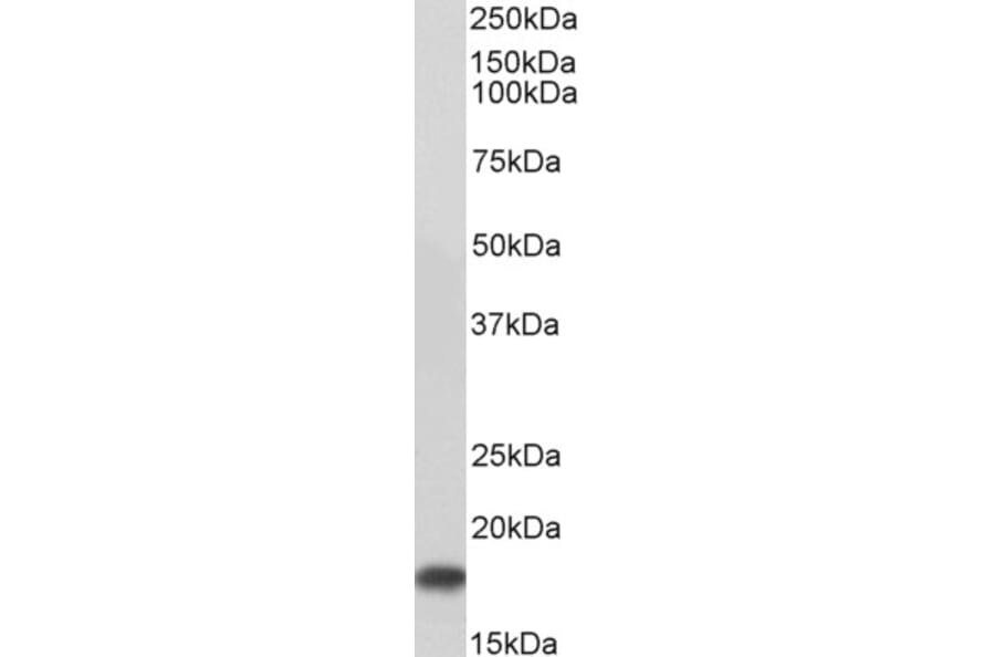 Western Blot - Anti-UBE2I Antibody (A83558) - Antibodies.com