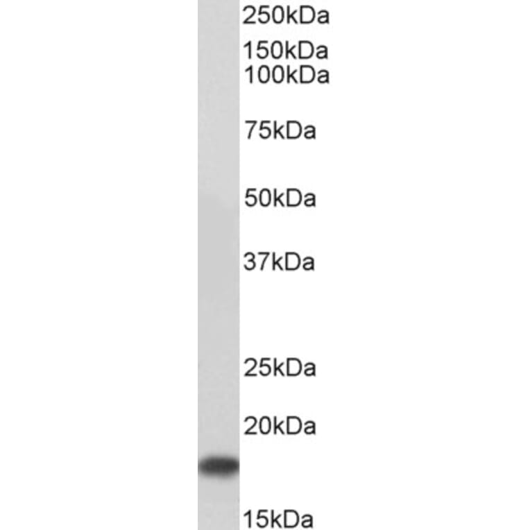 Western Blot - Anti-UBE2I Antibody (A83558) - Antibodies.com