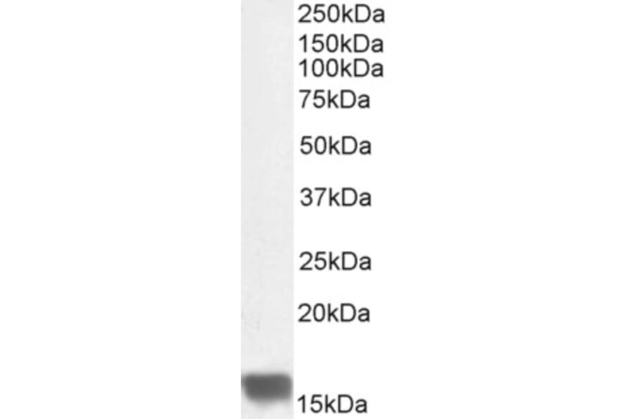 Western Blot - Anti-UBE2I Antibody (A83558) - Antibodies.com