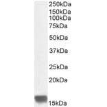Western Blot - Anti-UBE2I Antibody (A83558) - Antibodies.com