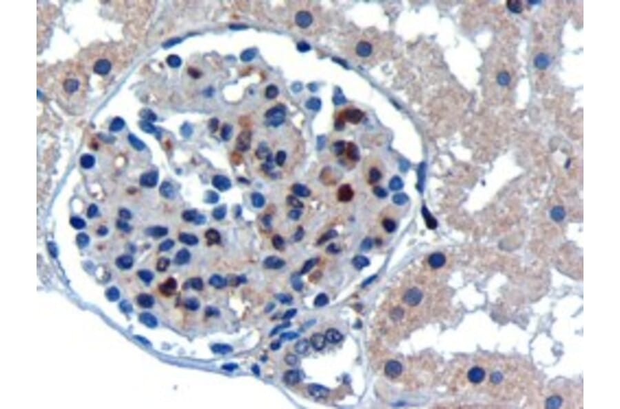 Immunohistochemistry - Anti-UBE2I Antibody (A83558) - Antibodies.com