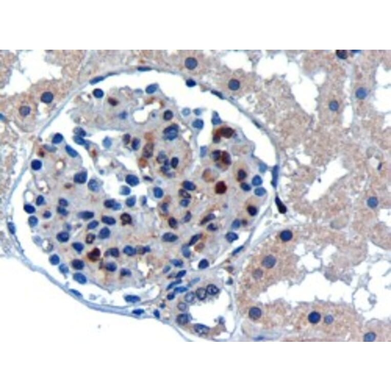 Immunohistochemistry - Anti-UBE2I Antibody (A83558) - Antibodies.com