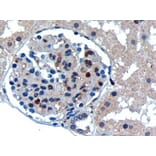 Immunohistochemistry - Anti-UBE2I Antibody (A83558) - Antibodies.com