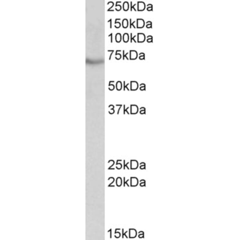 Western Blot - Anti-cIAP2 Antibody (A83560) - Antibodies.com