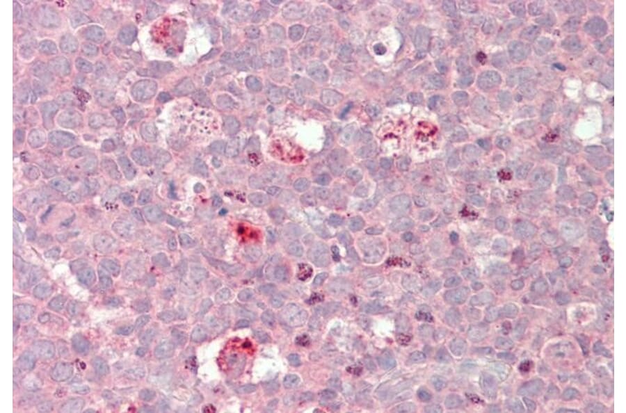 Immunohistochemistry - Anti-cIAP2 Antibody (A83560) - Antibodies.com