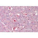 Immunohistochemistry - Anti-cIAP2 Antibody (A83560) - Antibodies.com