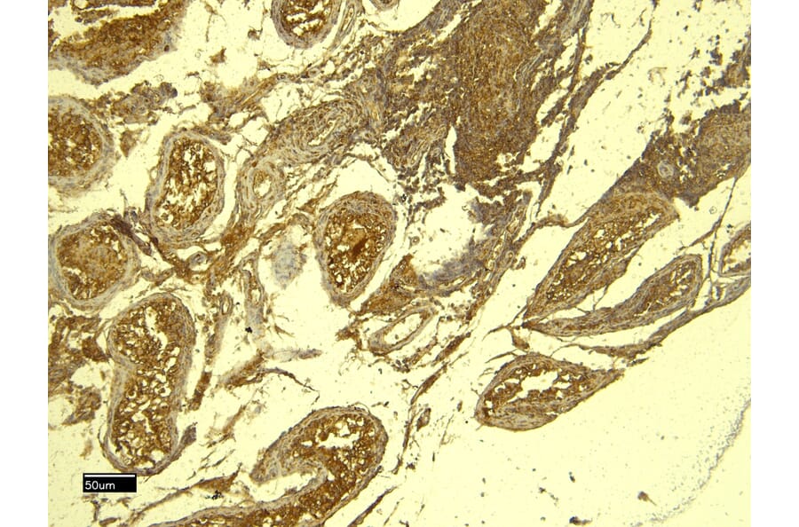 Immunohistochemistry - Anti-PCNA Antibody (A83561) - Antibodies.com
