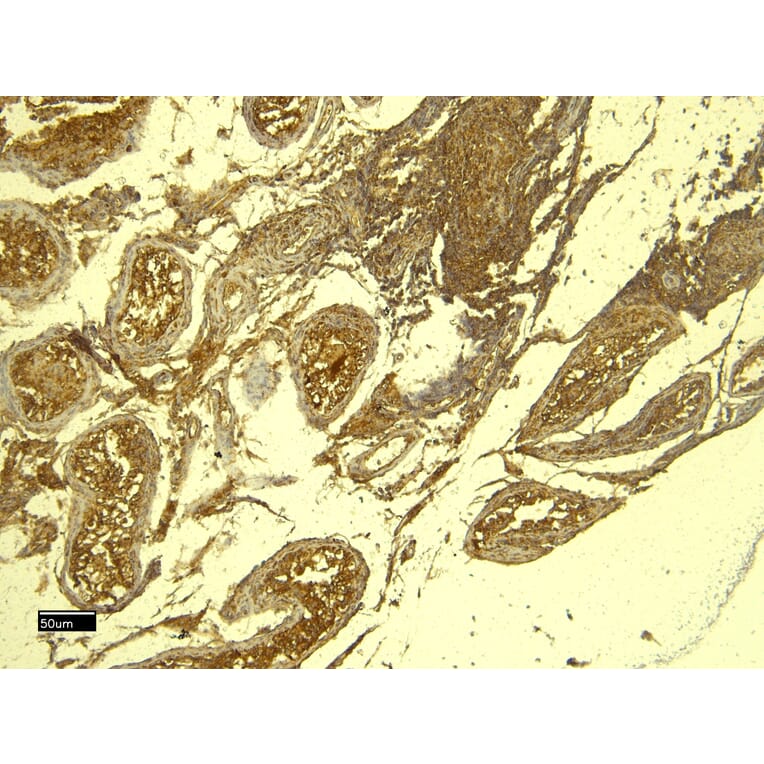 Immunohistochemistry - Anti-PCNA Antibody (A83561) - Antibodies.com