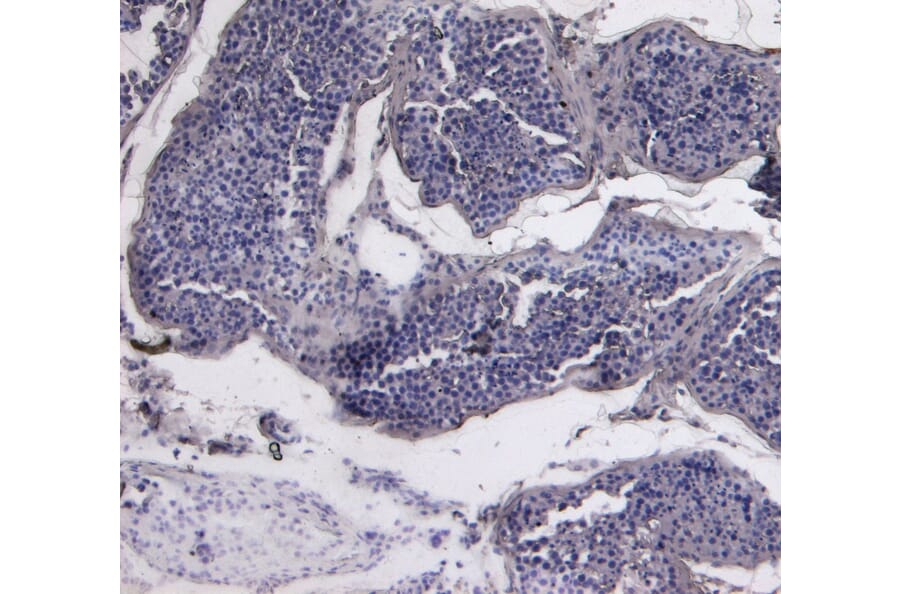 Immunohistochemistry - Anti-PCNA Antibody (A83561) - Antibodies.com