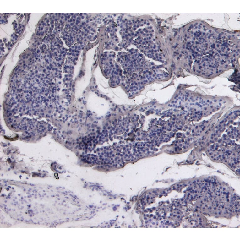 Immunohistochemistry - Anti-PCNA Antibody (A83561) - Antibodies.com