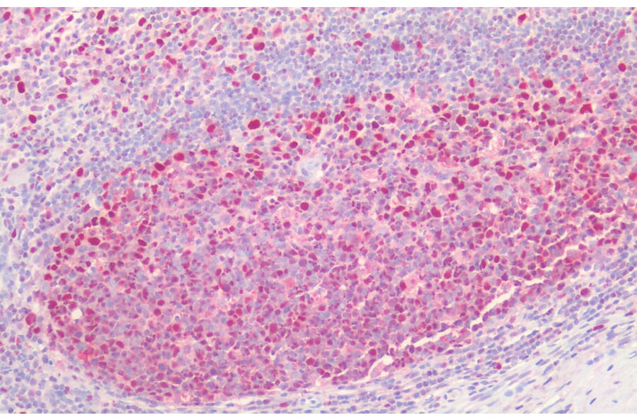 Immunohistochemistry - Anti-PCNA Antibody (A83563) - Antibodies.com
