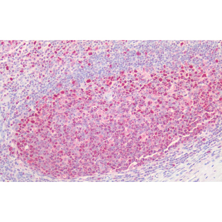 Immunohistochemistry - Anti-PCNA Antibody (A83563) - Antibodies.com