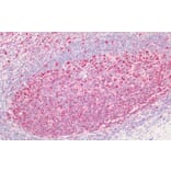 Immunohistochemistry - Anti-PCNA Antibody (A83563) - Antibodies.com