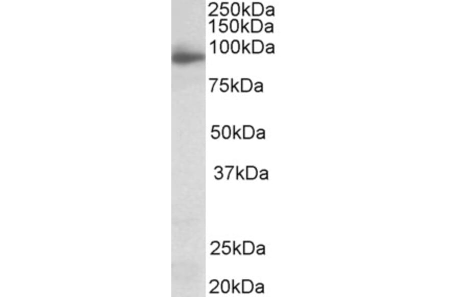 Western Blot - Anti-NLGN4X Antibody (A83565) - Antibodies.com