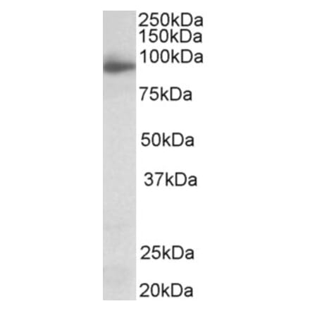 Western Blot - Anti-NLGN4X Antibody (A83565) - Antibodies.com