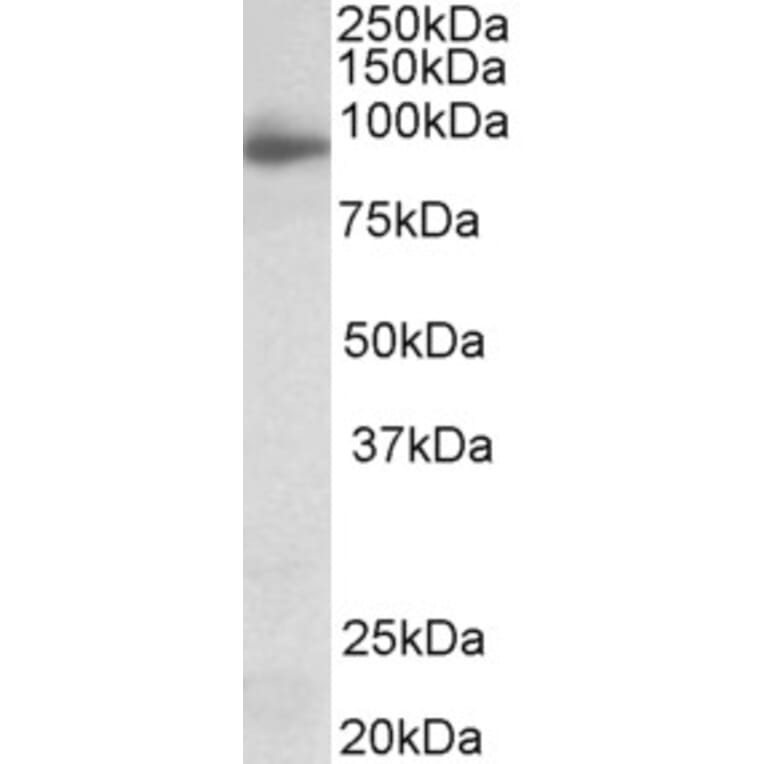 Western Blot - Anti-NLGN4X Antibody (A83565) - Antibodies.com