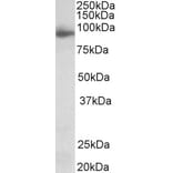 Western Blot - Anti-NLGN4X Antibody (A83565) - Antibodies.com