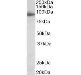 Western Blot - Anti-NLGN4X Antibody (A83565) - Antibodies.com