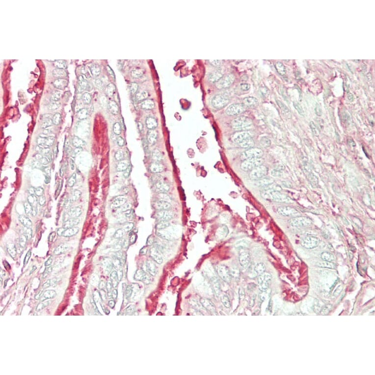 Immunohistochemistry - Anti-Arl6/BBS3 Antibody (A83566) - Antibodies.com
