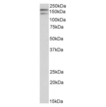 Western Blot - Anti-DUOX1 Antibody (A83567) - Antibodies.com