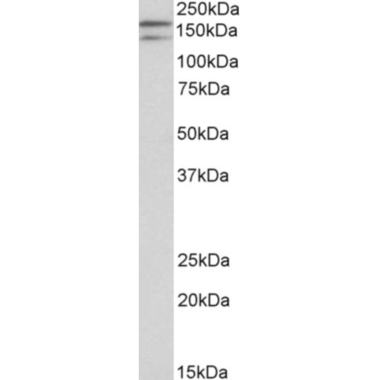 Western Blot - Anti-DUOX1 Antibody (A83567) - Antibodies.com