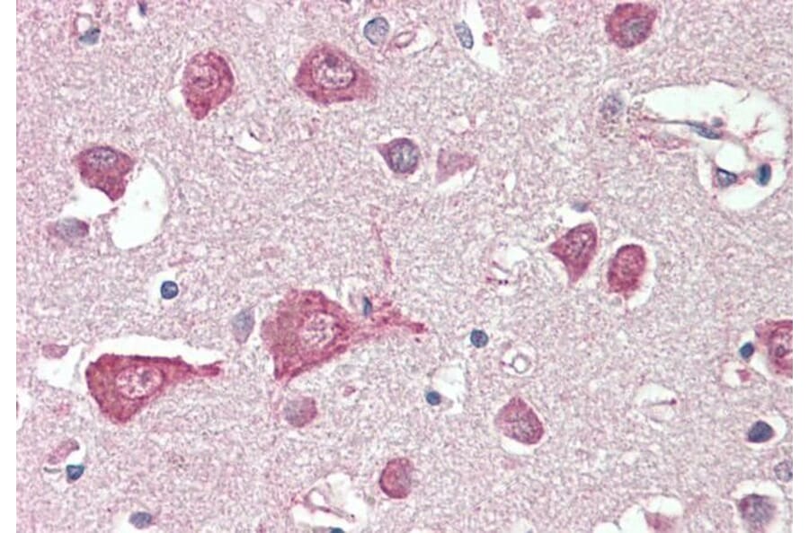 Immunohistochemistry - Anti-MLC1 Antibody (A83569) - Antibodies.com