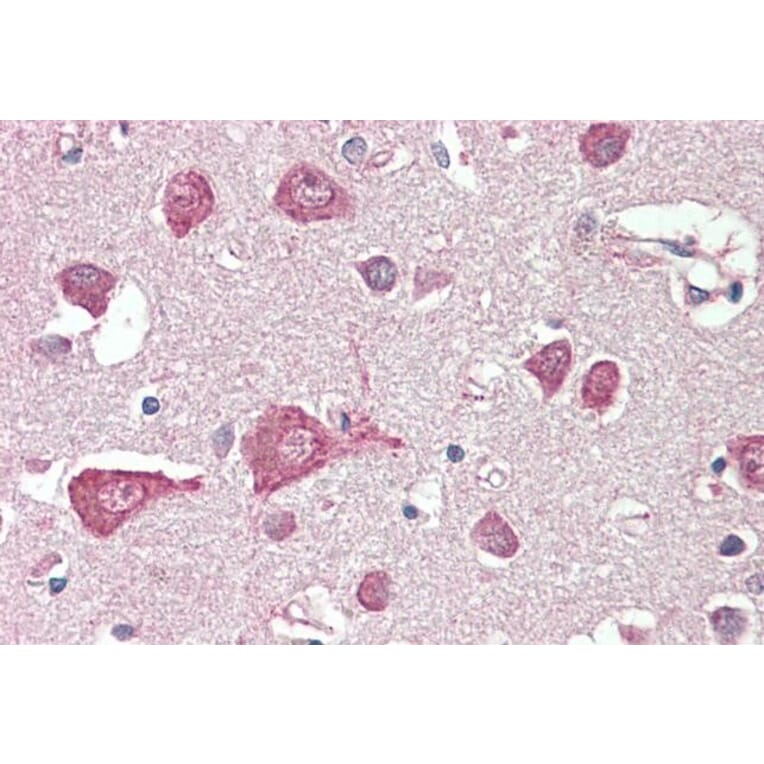 Immunohistochemistry - Anti-MLC1 Antibody (A83569) - Antibodies.com