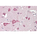 Immunohistochemistry - Anti-MLC1 Antibody (A83569) - Antibodies.com