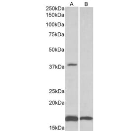 Western Blot - Anti-B3GAT1 Antibody (A83570) - Antibodies.com