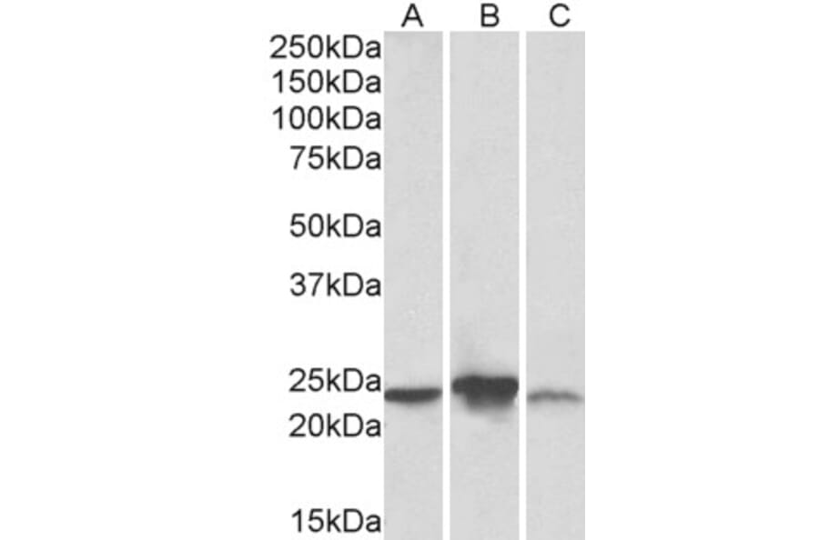 Western Blot - Anti-ABHD14B Antibody (A83573) - Antibodies.com
