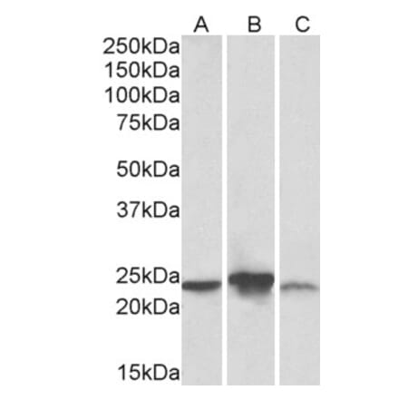 Western Blot - Anti-ABHD14B Antibody (A83573) - Antibodies.com