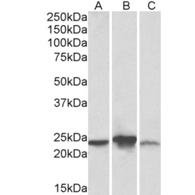 Western Blot - Anti-ABHD14B Antibody (A83573) - Antibodies.com