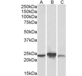 Western Blot - Anti-ABHD14B Antibody (A83573) - Antibodies.com