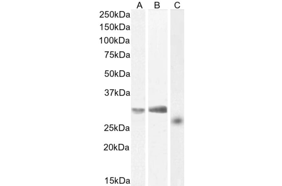 Western Blot - Anti-NTAL Antibody (A83574) - Antibodies.com