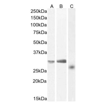 Western Blot - Anti-NTAL Antibody (A83574) - Antibodies.com