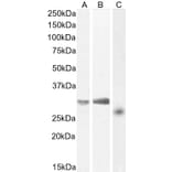 Western Blot - Anti-NTAL Antibody (A83574) - Antibodies.com