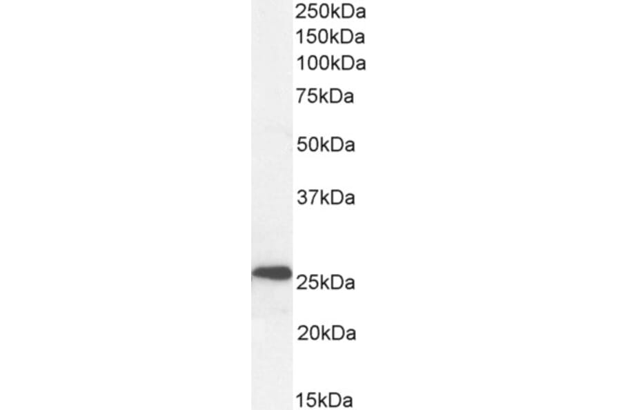 Western Blot - Anti-NTAL Antibody (A83574) - Antibodies.com