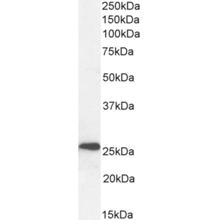 Western Blot - Anti-NTAL Antibody (A83574) - Antibodies.com