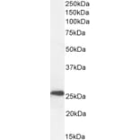 Western Blot - Anti-NTAL Antibody (A83574) - Antibodies.com